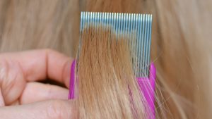 How Do You Tell If Nits Are Dead or Alive?
