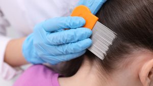 Will Lice Shampoo Actually Kill the Eggs?