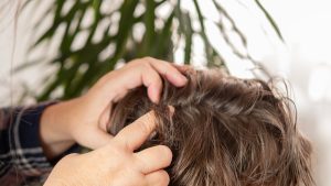 A mother in a Mt Pleasant home parts her school-age child's hair close to the scalp, looking for cemented nits versus loose dandruff flakes during an at-home head check.