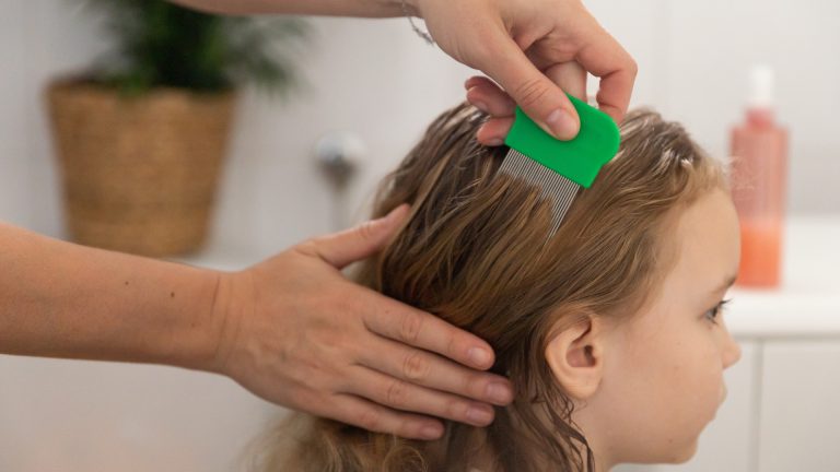 Is That Speck on the Lice Comb Actually a Nit?