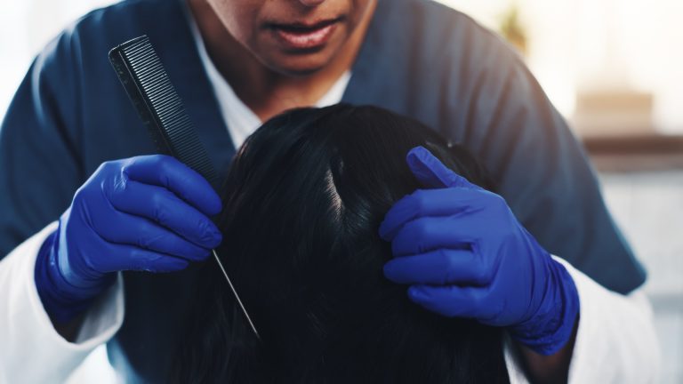 Why Summer Heat Won’t Kill Your Child’s Lice