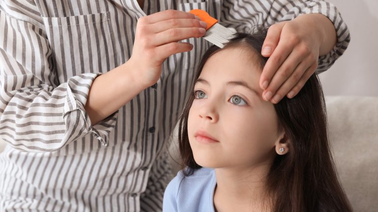 Lice, Fleas, or Bed Bugs: The Eggs Decide Who You Call