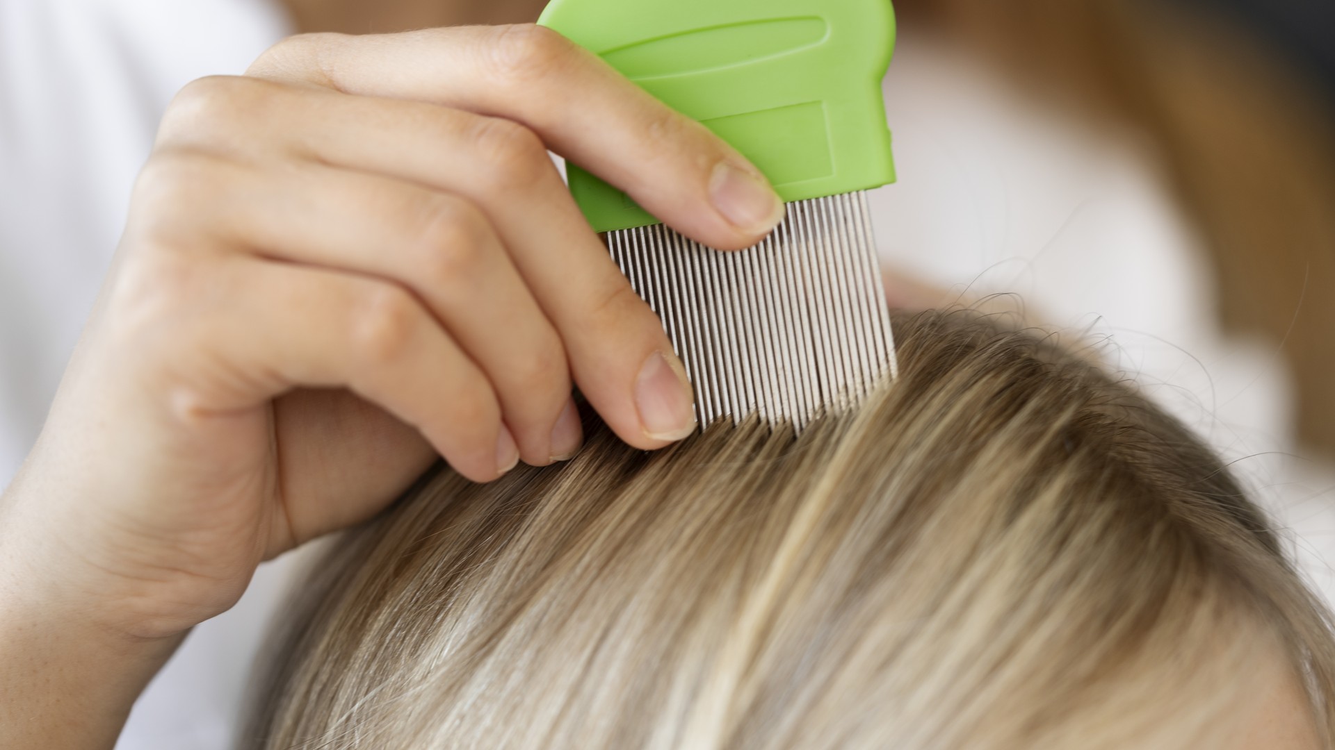 Upgraded: Lice Egg on Your Finger? A 10-Second Test